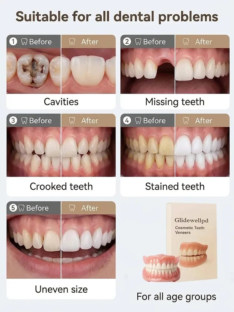 Custom-Fit Instant Smile Dentures – Natural Looking Comfort Fit