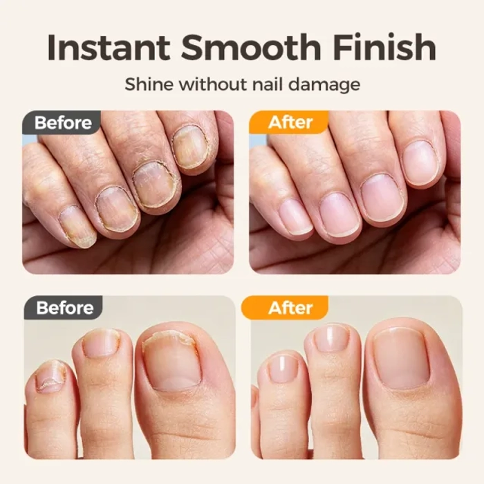 ⏳Time-Limited Special⏰2-in-1 Smart Electric Nail Trimmer & Polisher for All Ages 👨‍👩‍👧‍👦 – Blade-Free, Blood-Free & Stress-Free Nail Care! 💅